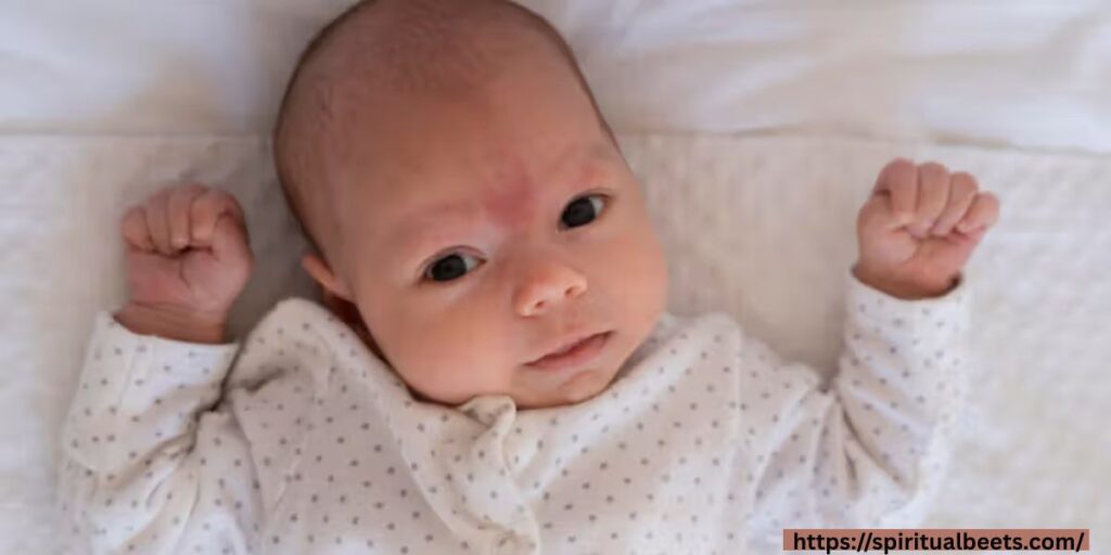 Angel kiss birthmark meaning