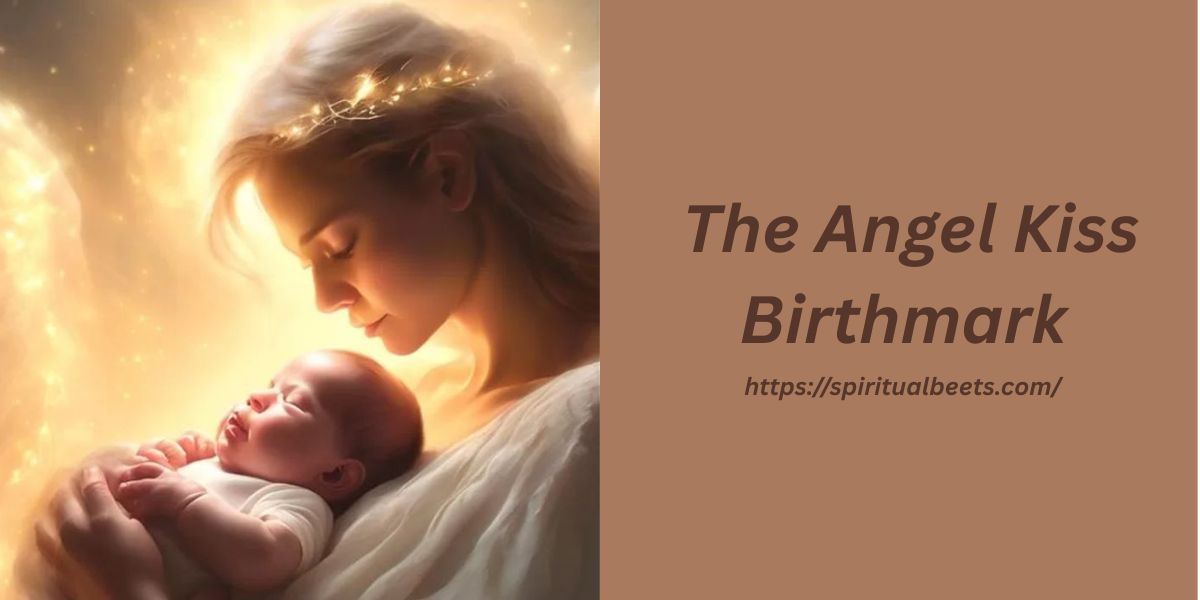 Spiritual Meaning Of The Angel Kiss Birthmark