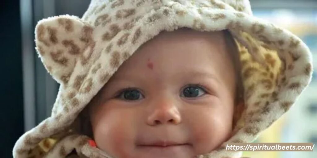angel kiss birthmark meaning myth