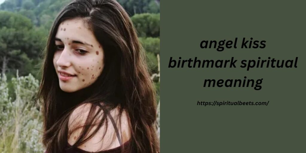 angel kiss birthmark spiritual meaning