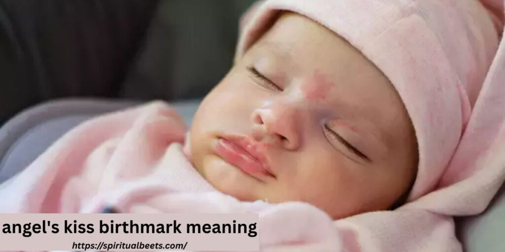 angel's kiss birthmark meaning