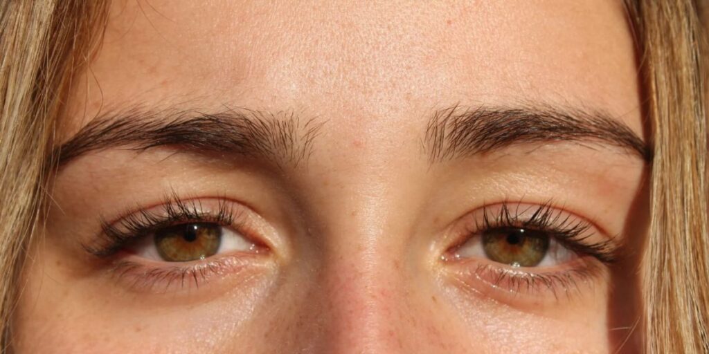 female right eye blinking